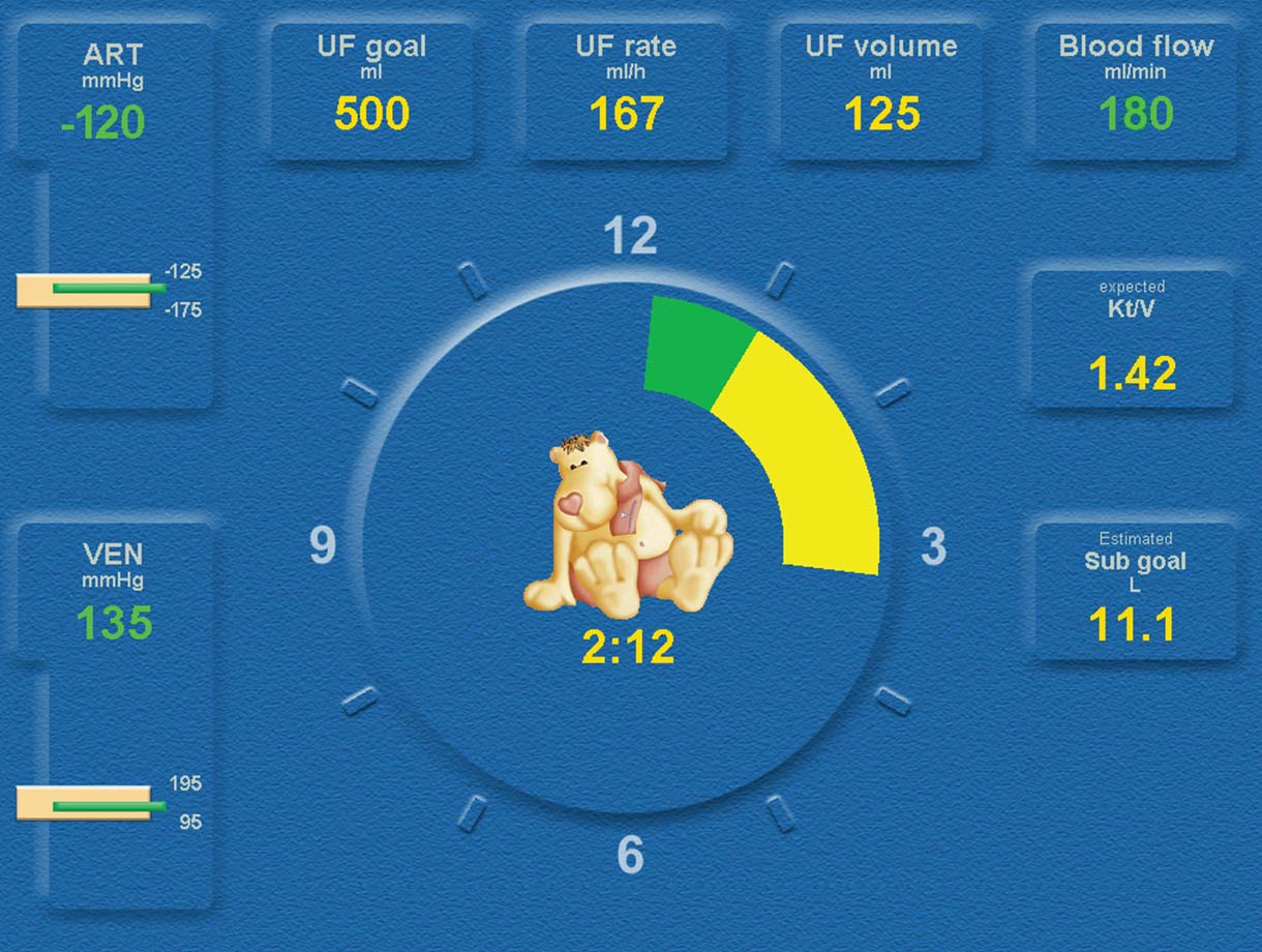 Fresenius Medical Care: protector de pantalla pediátrico de la 5008 CorDiax